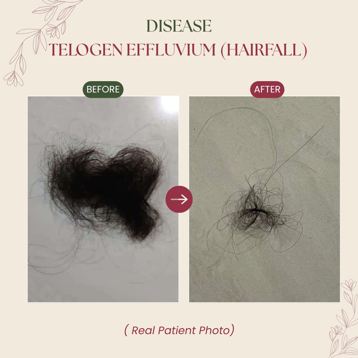 Before & After Patient Transformation BA-1