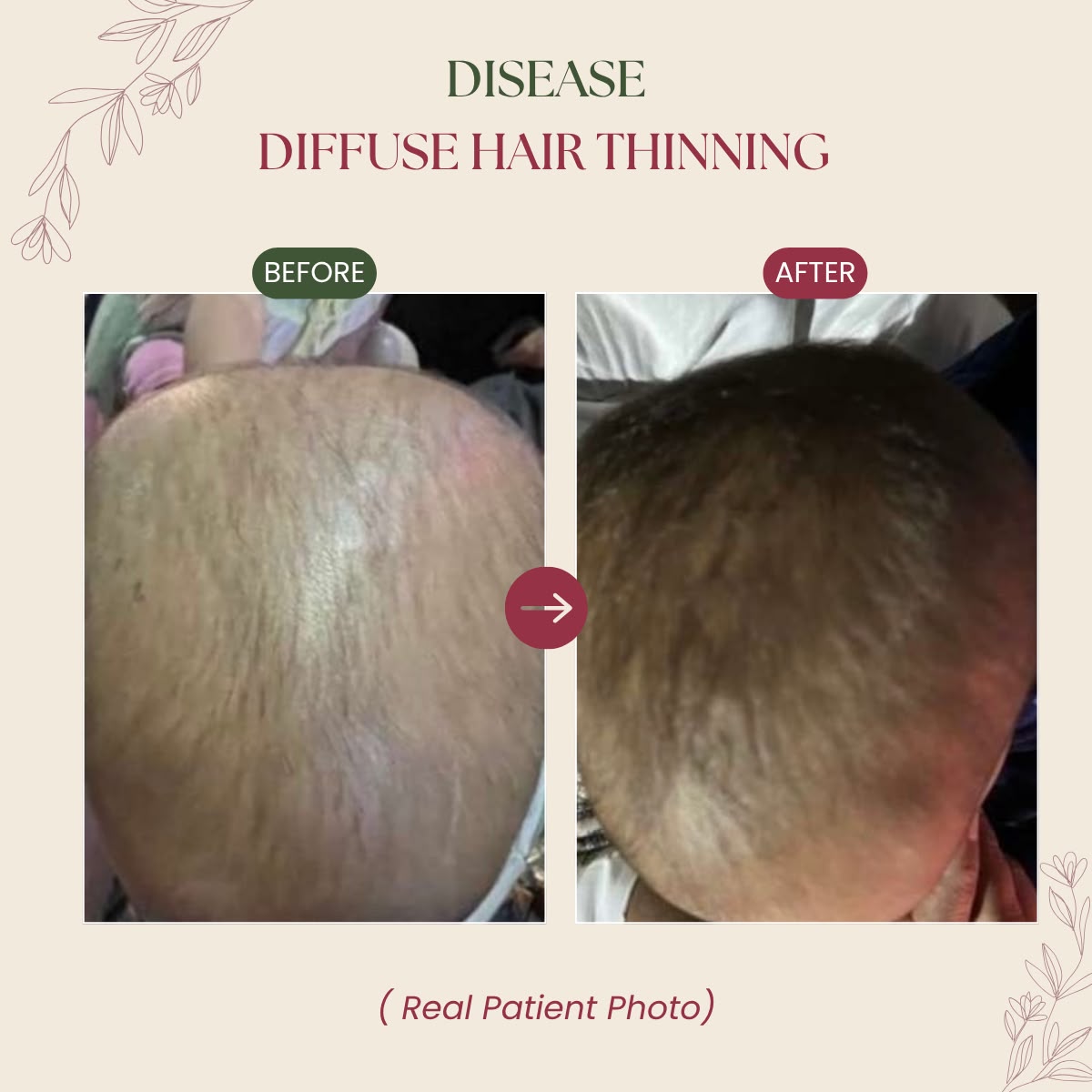 Before & After Patient Transformation BA-2